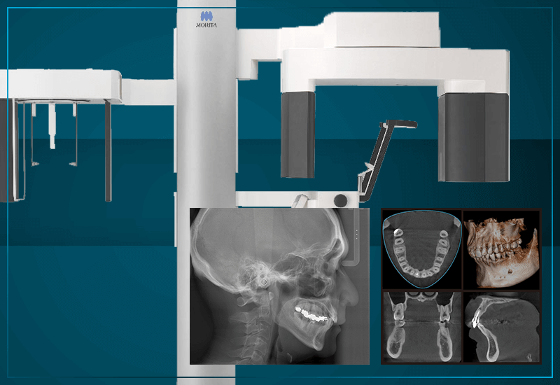 歯科用CT導入